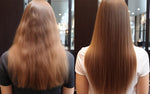 Exploring Nanoplastia: Before and After Impressions and Results – Dorofey Digital