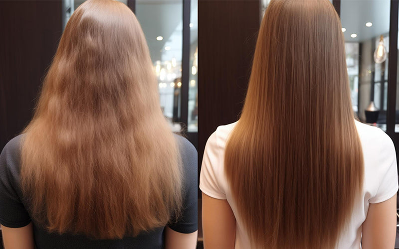 Exploring Nanoplastia: Before and After Impressions and Results – Dorofey Digital