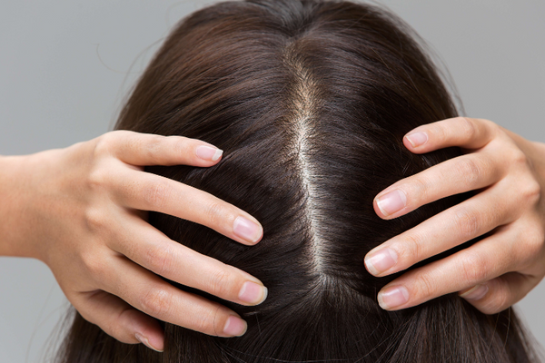 Side Effects of Nanoplastia Hair Treatment On Scalp