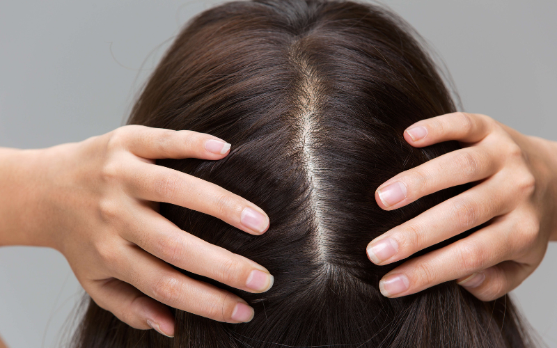Side Effects of Nanoplastia Hair Treatment On Scalp
